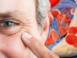 Homeopathic solutions for Excesses